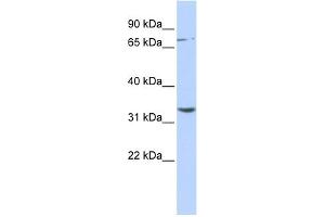 Image no. 1 for anti-Dpy-19-Like 1 (C. Elegans) (DPY19L1) (N-Term) antibody (ABIN2781313)