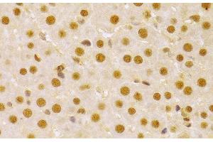 Immunohistochemistry of paraffin-embedded Rat liver using CDC25A Polyclonal Antibody at dilution of 1:100 (40x lens).