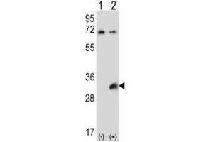 Image no. 2 for anti-Testis-Specific Serine Kinase 6 (TSSK6) (AA 197-228), (C-Term) antibody (ABIN955365)