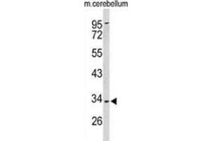Image no. 3 for anti-Peroxisomal Biogenesis Factor 2 (PEX2) (AA 172-202), (Middle Region) antibody (ABIN954099)