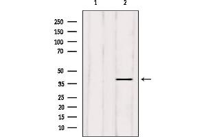 Image no. 2 for anti-ELAV (Embryonic Lethal, Abnormal Vision, Drosophila)-Like 2 (Hu Antigen B) (ELAVL2) (N-Term) antibody (ABIN6258767)