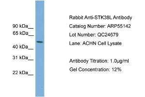 Image no. 2 for anti-serine/threonine Kinase 38 Like (STK38L) (Middle Region) antibody (ABIN2786071)
