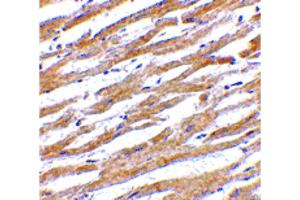 Image no. 1 for anti-Mitochondrial Antiviral Signaling Protein (MAVS) (Internal Region) antibody (ABIN6657099)
