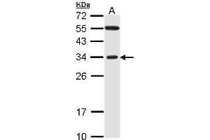 Image no. 2 for anti-F-Box Protein 2 (FBXO2) (C-Term) antibody (ABIN2855972)