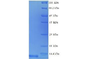 Image no. 1 for Chemokine (C-C Motif) Ligand 3 (CCL3) (AA 24-92), (full length) protein (His tag) (ABIN1046684)