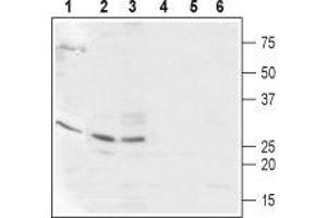 Western blot analysis of  Human ARPE-19 retinal epithelium (lanes 1 and 4), mouse heart (lanes 2 and 5), and rat heart (lanes 3 and 6) lysates: - 1-3.
