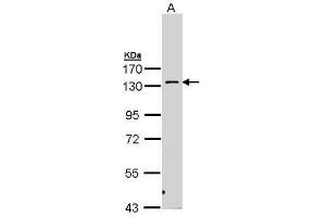 Image no. 1 for anti-Protein Kinase N2 (PKN2) (Center) antibody (ABIN2856817)
