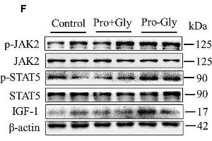 Image no. 4 for anti-Janus Kinase 2 (JAK2) (pTyr1007), (pTyr1008) antibody (ABIN740955)
