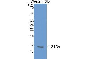 Image no. 1 for anti-Carboxypeptidase B2 (Plasma) (CPB2) (AA 309-374) antibody (ABIN1173307)