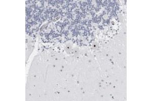 Image no. 2 for anti-WD Repeat Domain 3 (WDR3) antibody (ABIN5590880)