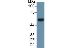 Image no. 2 for anti-Fascin (FSCN1) (AA 8-260) antibody (ABIN1174989)