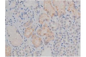 Image no. 4 for anti-FYN Oncogene Related To SRC, FGR, YES (FYN) (pTyr530) antibody (ABIN6256757)