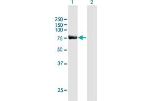 Image no. 1 for anti-SP100 Nuclear Antigen (SP100) (AA 1-480) antibody (ABIN520413)