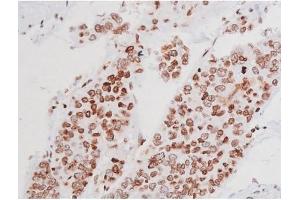 Image no. 10 for anti-Mast/stem Cell Growth Factor Receptor (KIT) (pTyr721) antibody (ABIN6256004)