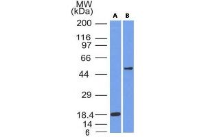 Image no. 1 for anti-SRY (Sex Determining Region Y)-Box 10 (SOX10) (AA 115-269) antibody (ABIN6940623)