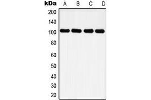 Image no. 2 for anti-Histone Deacetylase 7 (HDAC7) (C-Term) antibody (ABIN2704893)