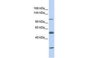 Image no. 1 for anti-Solute Carrier Family 39 (Zinc Transporter), Member 10 (SLC39A10) (AA 36-85) antibody (ABIN6743224)