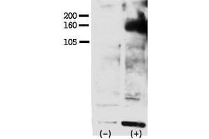 Image no. 1 for anti-V-Erb-A erythroblastic Leukemia Viral Oncogene Homolog 4 (Avian) (ERBB4) (pTyr1162) antibody (ABIN389572)