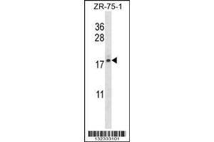 Image no. 1 for anti-Transition Protein 2 (During Histone To Protamine Replacement) (TNP2) (AA 88-116), (C-Term) antibody (ABIN656736)