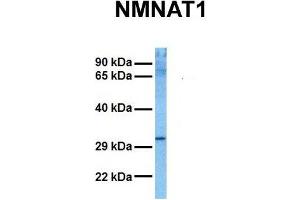 Image no. 2 for anti-Nicotinamide Nucleotide Adenylyltransferase 1 (NMNAT1) (N-Term) antibody (ABIN2783549)