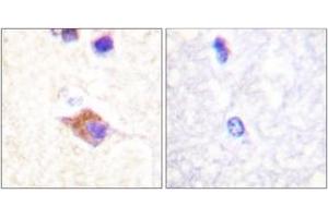 Image no. 1 for anti-Phospholipase C gamma 2 (PLCG2) (AA 1186-1235), (pTyr1217) antibody (ABIN1531375)