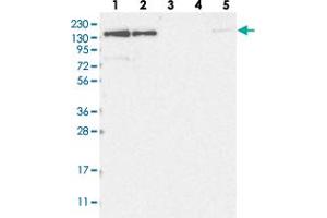 Image no. 2 for anti-Nucleoporin 153kDa (NUP153) antibody (ABIN5584851)