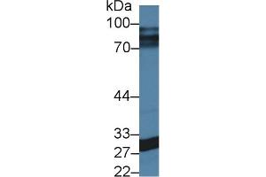 CA5A Antikörper  (AA 12-219)