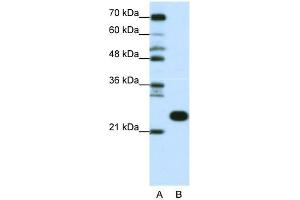Image no. 1 for anti-Ribosomal Protein L13 (RPL13) (C-Term) antibody (ABIN2778677)