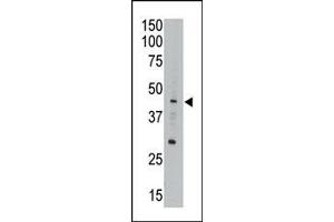 Image no. 1 for anti-Apolipoprotein B mRNA Editing Enzyme, Catalytic Polypeptide-Like 3G (APOBEC3G) (AA 118-148) antibody (ABIN388141)