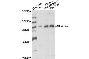 Image no. 1 for anti-Spermatogenesis Associated 7 (SPATA7) antibody (ABIN6292521)
