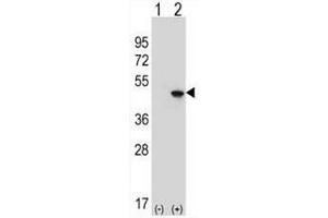 Image no. 3 for anti-Eukaryotic Translation Initiation Factor 4A2 (EIF4A2) (AA 339-369), (C-Term) antibody (ABIN952052)
