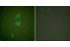 Image no. 1 for anti-Histone Deacetylase 5 (HDAC5) (AA 1073-1122) antibody (ABIN1533305)