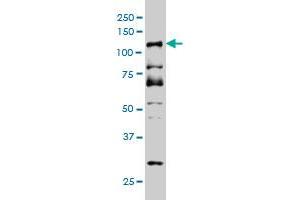 Image no. 2 for anti-Cyclin D Binding Myb-Like Transcription Factor 1 (DMTF1) (AA 661-760) antibody (ABIN564296)