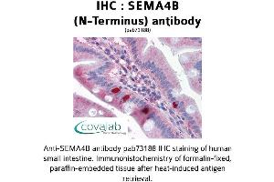 Image no. 1 for anti-Sema Domain, Immunoglobulin Domain (Ig), Transmembrane Domain (TM) and Short Cytoplasmic Domain, (Semaphorin) 4B (SEMA4B) (N-Term) antibody (ABIN1739129)