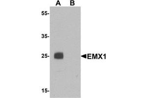 Image no. 1 for anti-Empty Spiracles Homeobox 1 (EMX1) (N-Term) antibody (ABIN1450103)