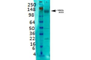Image no. 2 for anti-Solute Carrier Family 12 (Potassium-Chloride Transporter) Member 5 (SLC12A5) (AA 932-1043) antibody (Alkaline Phosphatase (AP)) (ABIN2484115)
