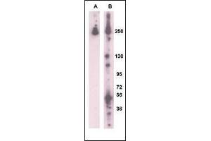 Image no. 1 for anti-Leucine-Rich Repeat Kinase 2 (LRRK2) (AA 931-962) antibody (ABIN1882109)