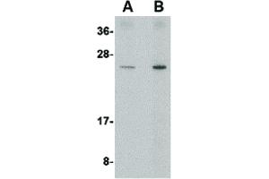 Image no. 1 for anti-DNA-Damage-Inducible Transcript 4 (DDIT4) (Internal Region) antibody (ABIN6656848)