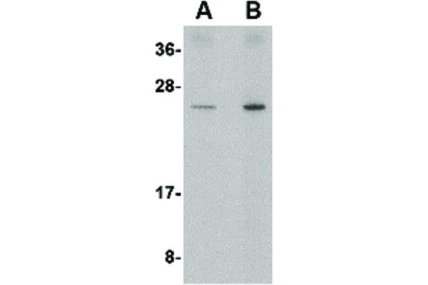 anti-DNA-Damage-Inducible Transcript 4 (DDIT4) (Internal Region) antibody