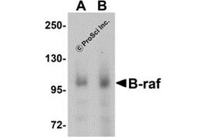 Image no. 2 for anti-Small Nuclear Ribonucleoprotein Polypeptide E (SNRPE) (Middle Region) antibody (ABIN1030878)