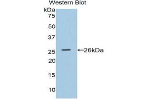Image no. 1 for anti-Coagulation Factor VIII-Associated 1 (F8A1) (AA 171-375) antibody (ABIN1858769)