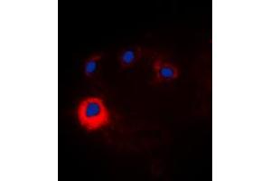 Image no. 1 for anti-Notch 1 (NOTCH1) (Center) antibody (ABIN2706704)