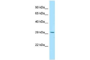 anti-RWD Domain Containing 3 (RWDD3) (Middle Region) antibody
