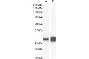 Image no. 6 for anti-Stratifin (SFN) (Internal Region) antibody (ABIN185539)
