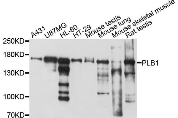 anti-Phospholipase B (PLB) antibody