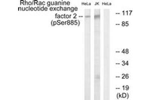 Western blot analysis of extracts from HeLa cells treated with TSA 400nM 24H and Jurkat cells treated with forskolin 40nM 30', using Rho/Rac Guanine Nucleotide Exchange Factor 2 (Phospho-Ser885) Antibody.