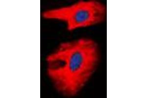 Image no. 1 for anti-Collagen, Type I, alpha 2 (COL1A2) (Center) antibody (ABIN2705909)