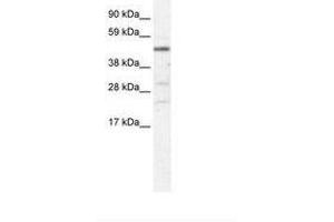 Image no. 1 for anti-Heat Shock Transcription Factor, Y-Linked 1 (HSFY1) (AA 97-146) antibody (ABIN203112)