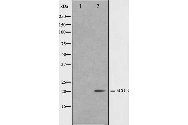 anti-HCG beta antibody