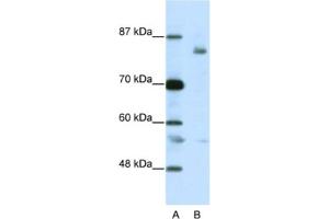 Image no. 1 for anti-Leucine-Zipper-Like Transcription Regulator 1 (LZTR1) antibody (ABIN2461800)